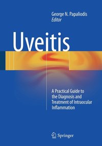 bokomslag Uveitis