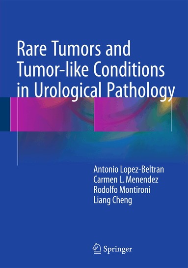 Antonio Lopez-Beltran, Carmen L. Menendez, Rodolfo Montironi, Liang Cheng - Rare Tumors and Tumor-like Conditions in Urological Pathology, Inbunden