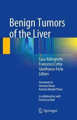 Benign Tumors of the Liver 1