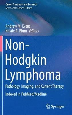 bokomslag Non-Hodgkin Lymphoma