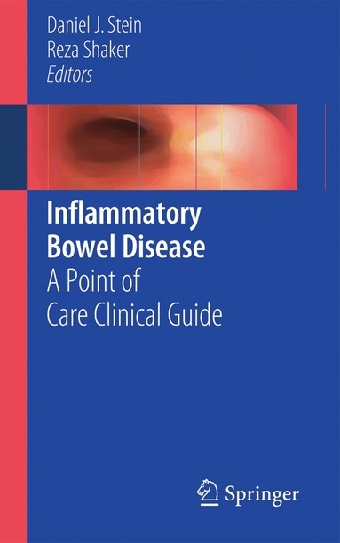 Daniel J. Stein, Reza Shaker - Inflammatory Bowel Disease, Häftad