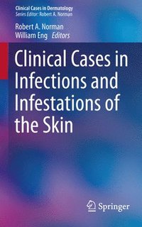 bokomslag Clinical Cases in Infections and Infestations of the Skin