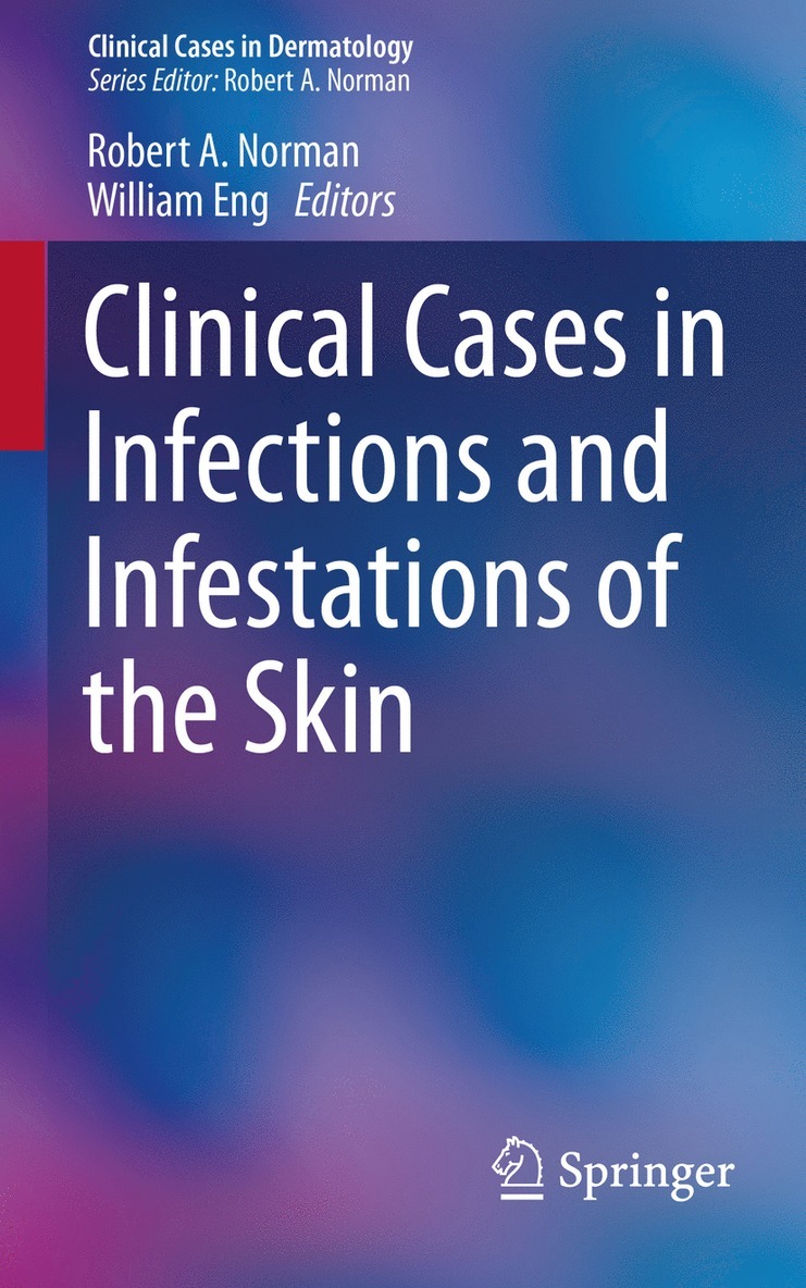 Clinical Cases in Infections and Infestations of the Skin