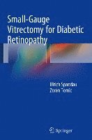 bokomslag Small-Gauge Vitrectomy for Diabetic Retinopathy