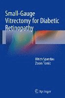 Ulrich Spandau, Ulrich Spandau - Small-Gauge Vitrectomy for Diabetic Retinopathy, Inbunden