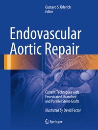 bokomslag Endovascular Aortic Repair