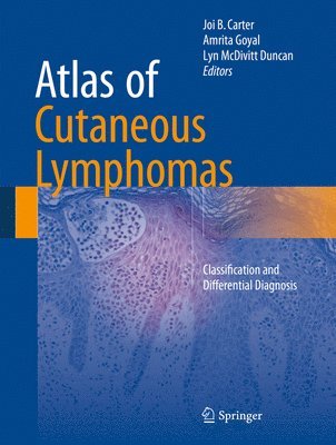 Joi B. Carter, Amrita Goyal, Lyn McDivitt Duncan - Atlas of Cutaneous Lymphomas, Inbunden