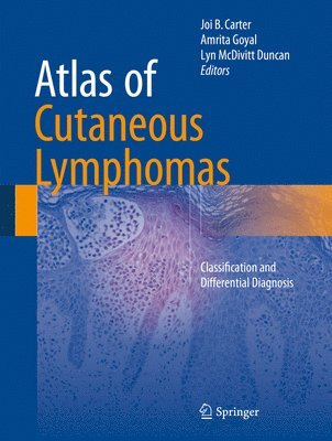 Atlas of Cutaneous Lymphomas 1