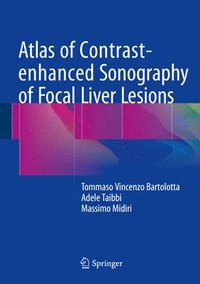 bokomslag Atlas of Contrast-enhanced Sonography of Focal Liver Lesions