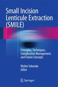 bokomslag Small Incision Lenticule Extraction (SMILE)