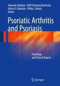 bokomslag Psoriatic Arthritis and Psoriasis