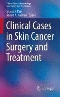 bokomslag Clinical Cases in Skin Cancer Surgery and Treatment