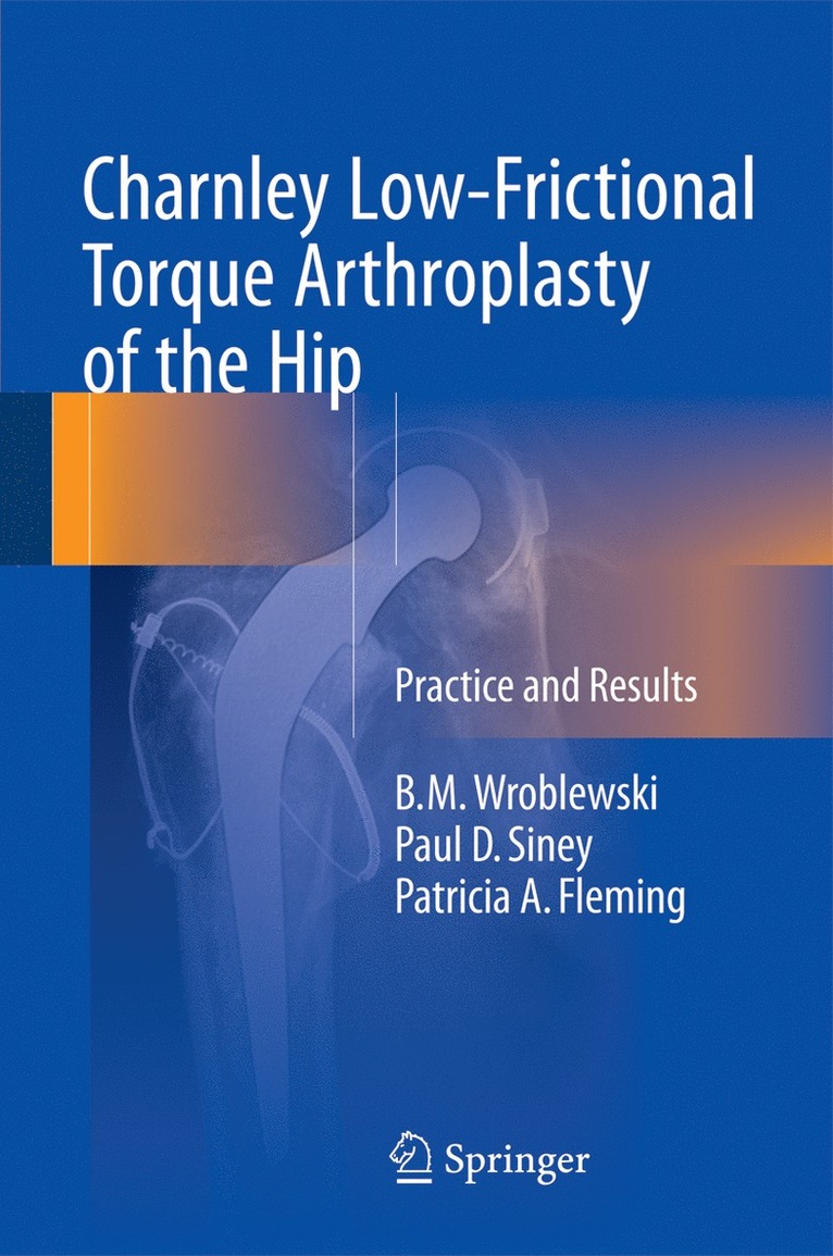 B.M. Wroblewski, Paul D. Siney, Patricia A. Fleming, B. M. Wroblewski - Charnley Low-Frictional Torque Arthroplasty of the Hip, Inbunden