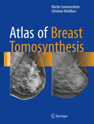 bokomslag Atlas of Breast Tomosynthesis