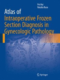 bokomslag Atlas of Intraoperative Frozen Section Diagnosis in Gynecologic Pathology