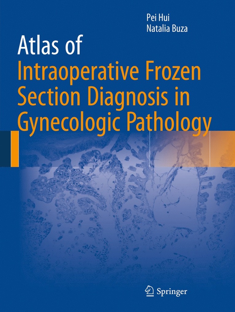 Pei Hui, Natalia Buza - Atlas of Intraoperative Frozen Section Diagnosis in Gynecologic Pathology, Inbunden
