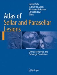 bokomslag Atlas of Sellar and Parasellar Lesions