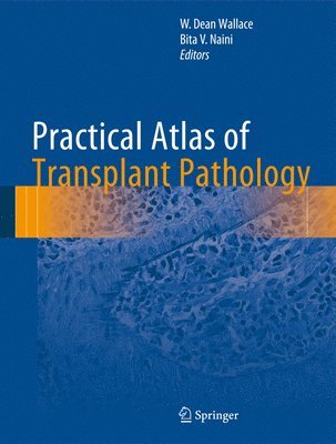 W. Dean Wallace, Bita V. Naini - Practical Atlas of Transplant Pathology, Inbunden