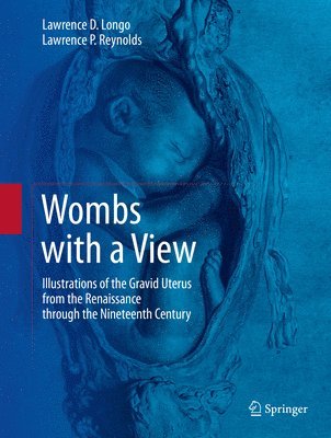 Wombs with a View 1