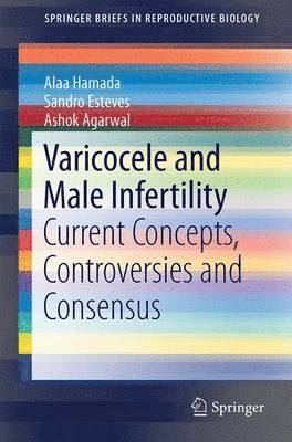 Varicocele and Male Infertility 1