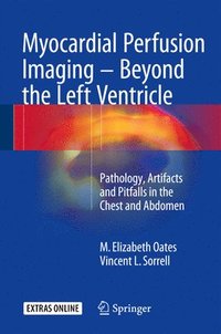 bokomslag Myocardial Perfusion Imaging - Beyond the Left Ventricle