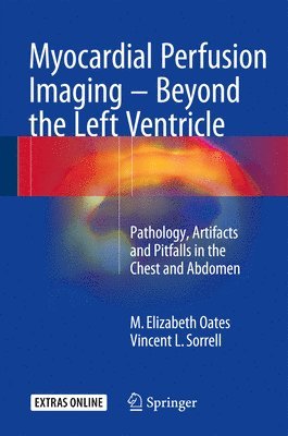 bokomslag Myocardial Perfusion Imaging - Beyond the Left Ventricle