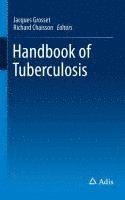 bokomslag Handbook of Tuberculosis