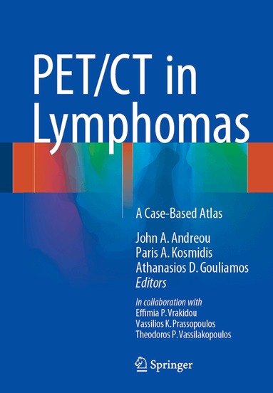 John A. Andreou, Paris A. Kosmidis, Athanasios D. Gouliamos - PET/CT in Lymphomas, Inbunden