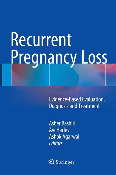 bokomslag Recurrent Pregnancy Loss