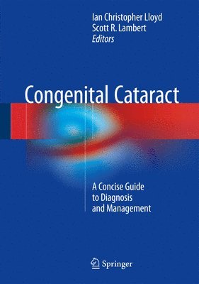 bokomslag Congenital Cataract