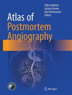 Silke Grabherr, Jochen M. Grimm, Axel Heinemann - Atlas of Postmortem Angiography, Inbunden