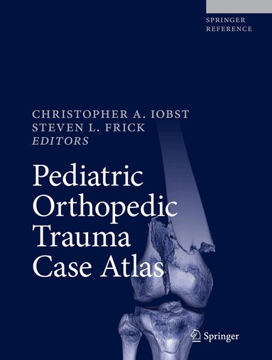 Christopher A. Iobst, Steven L. Frick - Pediatric Orthopedic Trauma Case Atlas, Inbunden