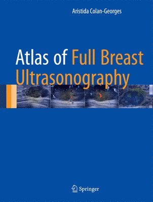 bokomslag Atlas of Full Breast Ultrasonography