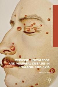 bokomslag Medicine, Knowledge and Venereal Diseases in England, 1886-1916