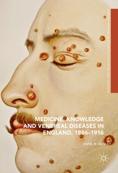 bokomslag Medicine, Knowledge and Venereal Diseases in England, 1886-1916