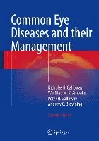 Common Eye Diseases and their Management 1