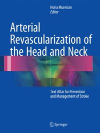 bokomslag Arterial Revascularization of the Head and Neck