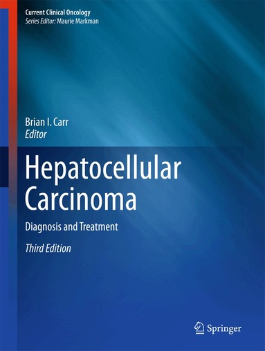 Brian I. Carr - Hepatocellular Carcinoma, Inbunden
