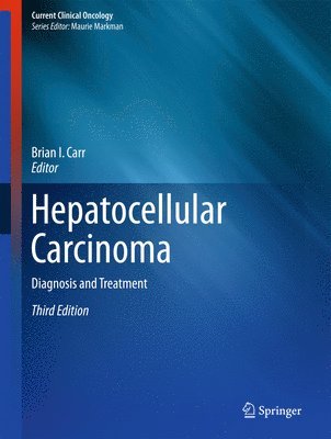 Brian I. Carr - Hepatocellular Carcinoma, Inbunden