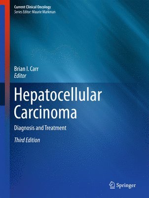 Hepatocellular Carcinoma 1