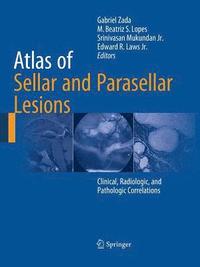 bokomslag Atlas of Sellar and Parasellar Lesions