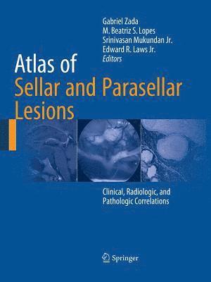 Atlas of Sellar and Parasellar Lesions 1