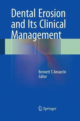 Dental Erosion and Its Clinical Management 1