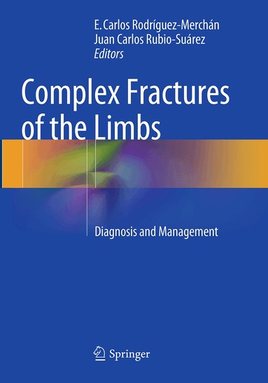 E. Carlos Rodríguez-Merchán, Juan Carlos Rubio-Suárez - Complex Fractures of the Limbs, Häftad