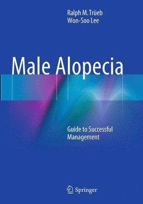 Male Alopecia 1