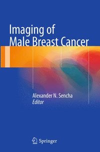 bokomslag Imaging of Male Breast Cancer