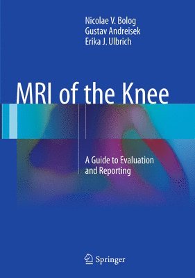 bokomslag MRI of the Knee