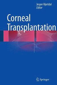 bokomslag Corneal Transplantation