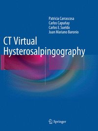 bokomslag CT Virtual Hysterosalpingography