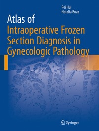 bokomslag Atlas of Intraoperative Frozen Section Diagnosis in Gynecologic Pathology